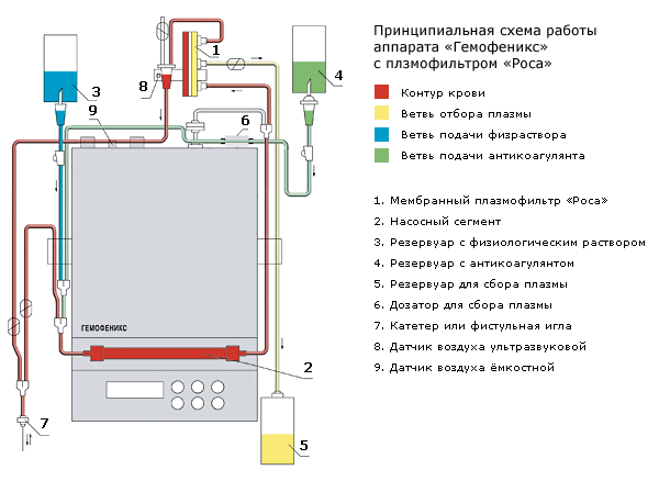 плазмаферез схема