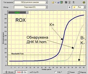 дт96-5